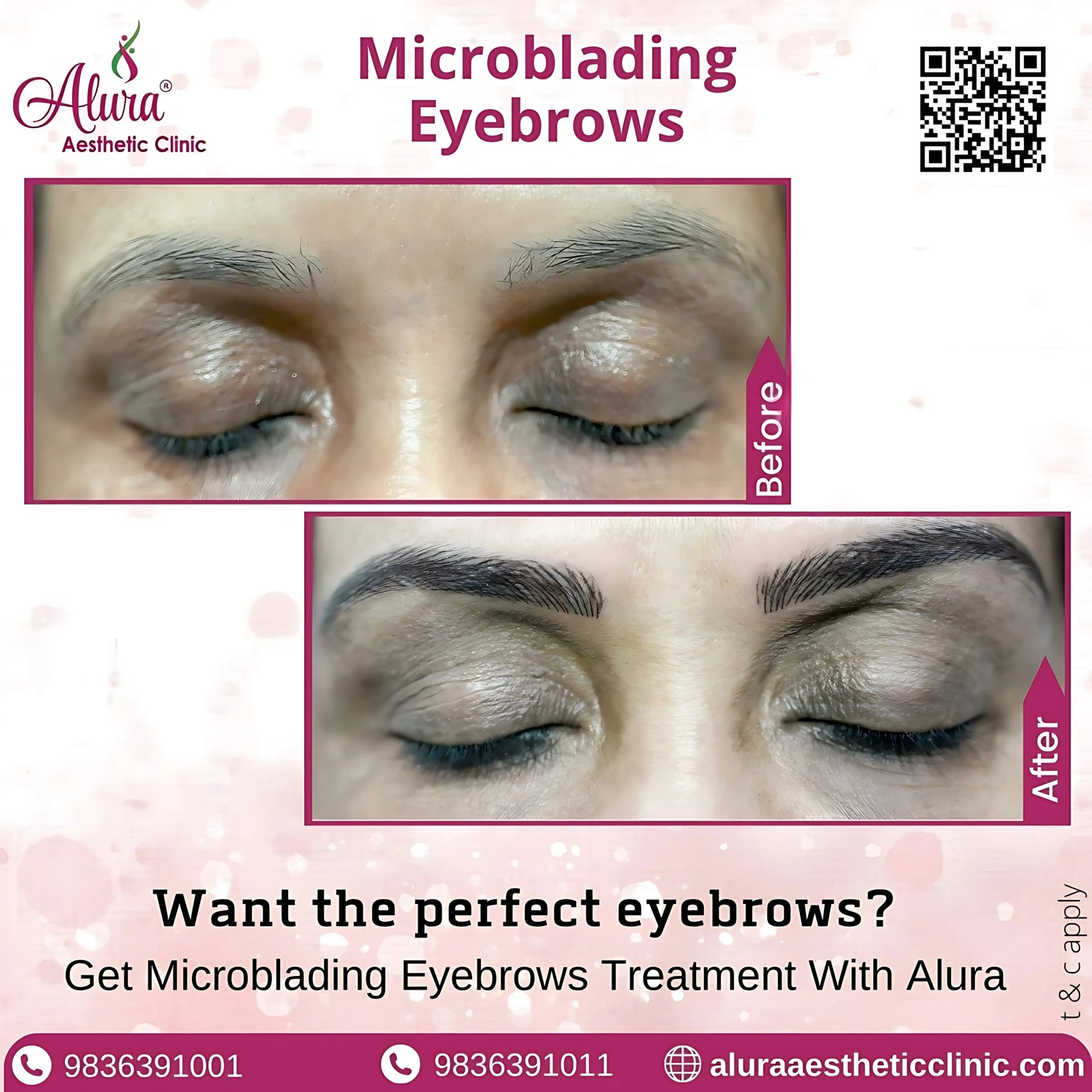 Microblading